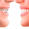 ORAL-B Essential Floss NIĆ DENTYSTYCZNA NIEWOSKOWANA 50m 1 sztuka