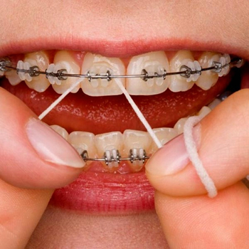 Nić dentystyczna woskowana waxed ORAL-B Essential Floss 50 m